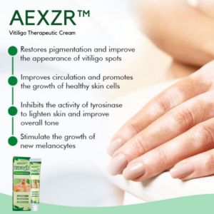 AEXZR™ Vitiligo Therapeutic Cream