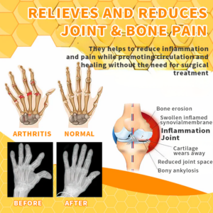 AQA™ Bee Venom Joint Therapy Pain Relief Gel