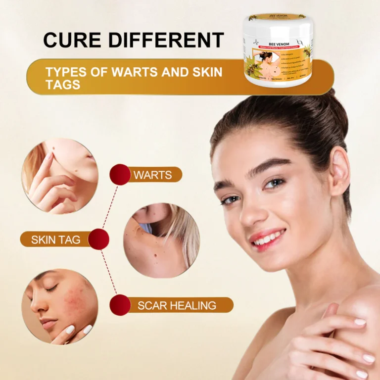 Bee Venom Mole and Wart Treatment Cream - Image 4