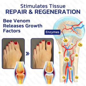 FLYCARE™ Bee Venom Joint and Bone Therapy Cream