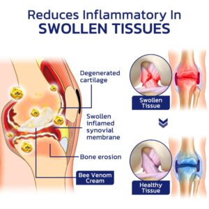 GFOUK™ Beeliefe Bee Venom Joint And Bone Therapy Cream