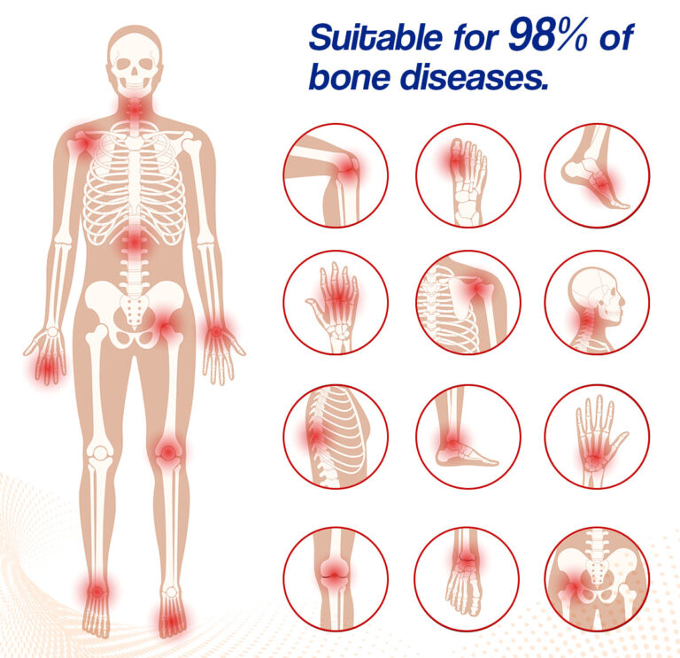 Ourlyard™ Bee Venom Joint Therapy Cream: Relieve stiffness and swelling