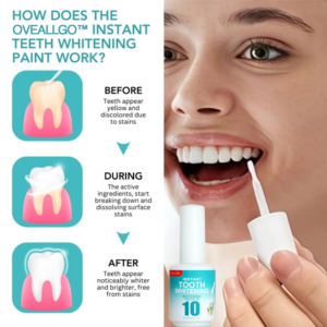 Oveallgo™ Instant Teeth Whitening Paint