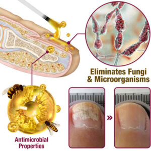 flysmus™ FungiFres Bee Venom Nail Treatment Serum