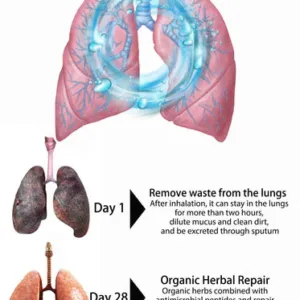 AEXZR™ Organic Herbal Lung Cleanse Repair Nasal Spray