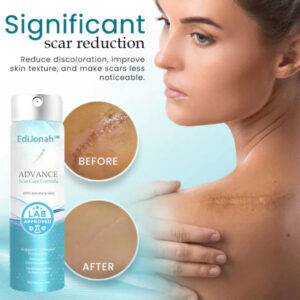 EdiJonah™ Advance Scar Care Formula