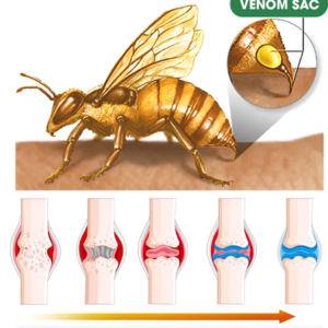 FLYCARE™ Bee Venom Advanced Joint and Bone Therapy Cream