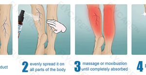 FLYCARE™ Varicose Veins Spray