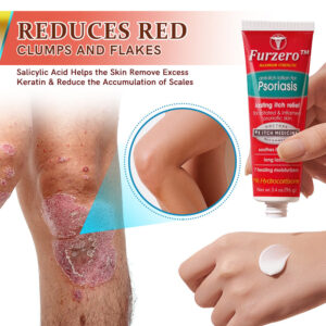 Furzero™ Psoriasis Anti-Itch Treatment Lotion