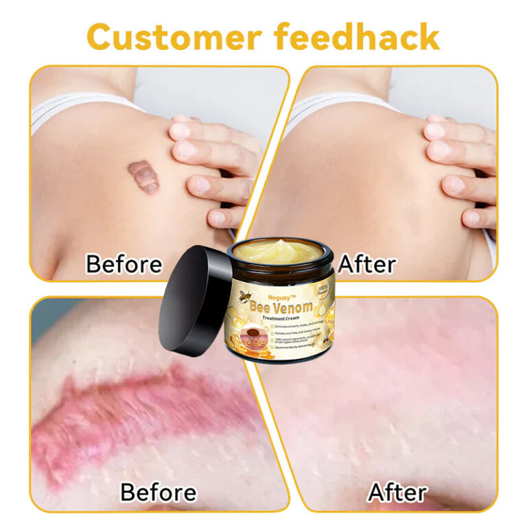 Negusy™ Bee Venom Skin Treatment Cream