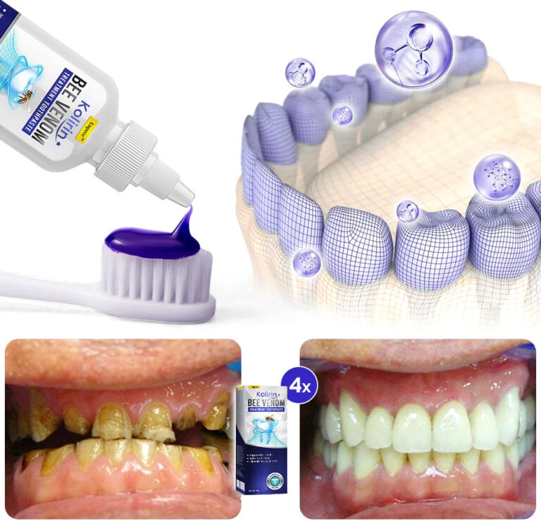 UNPREE™ Kolirin Bee Venom Treatment Toothpaste