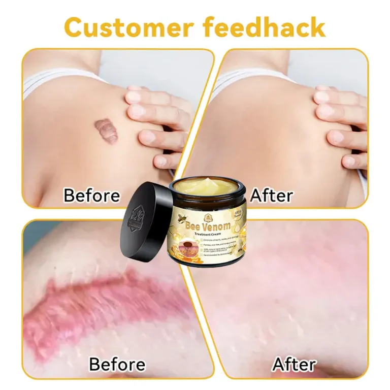 flysmus™ Bee Venom Skin Treatment Cream - Image 9