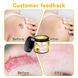 𝑇𝑢𝑟𝑜𝑛𝑢™ Bee Venom Skin Treatment Cream