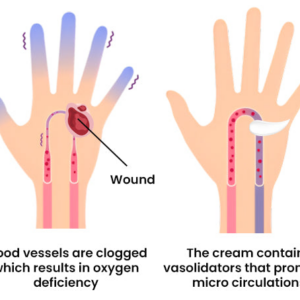 FLYCARE™ Diabetic Wounds Healing Ointment