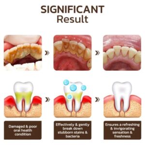 Niacinamide Intensive Whitening Toothpaste