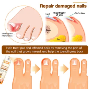 Ourlyard™ Bee Venom Nail Fungus Spray