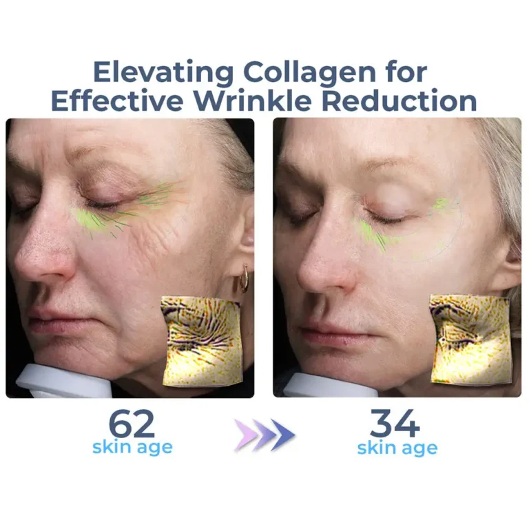 flysmus™ Collagen Flawless Complete Eye Cream