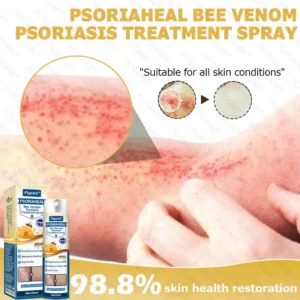 FLYCARE™ PsoriaHeal Bee Venom Psoriasis Treatment Spray