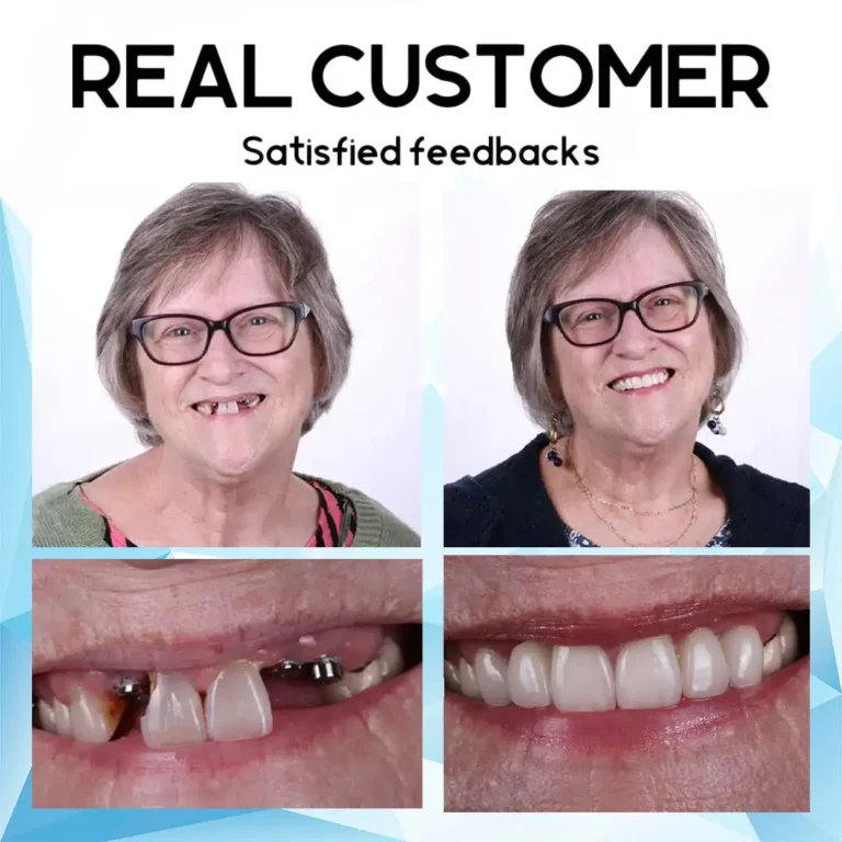 Oveallgo™ Silicone Reline Denture Set