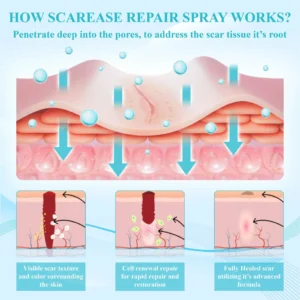 ScarEase™ Premium SkinRecovery Spray