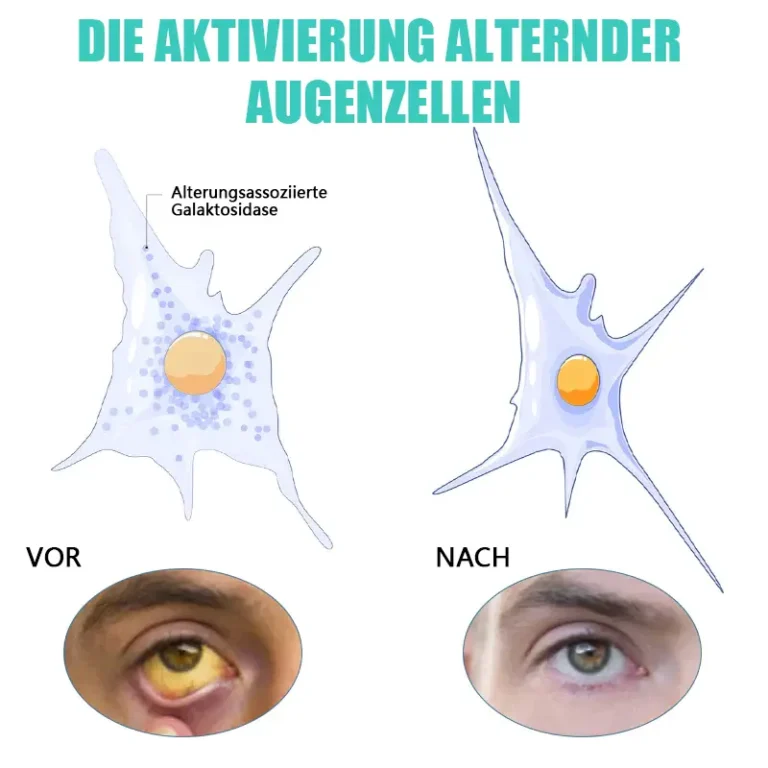 Bostorer™ Augentropfen zur Behandlung von Sehproblemen