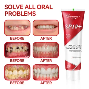 Dormorna ™ SP10+ Probiotic Regenerative Silicon Repair Cavity Whitening Toothpaste