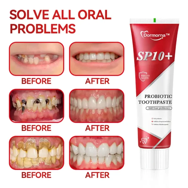 Dormorna ™ SP10+ Probiotic Regenerative Silicon Repair Cavity Whitening Toothpaste