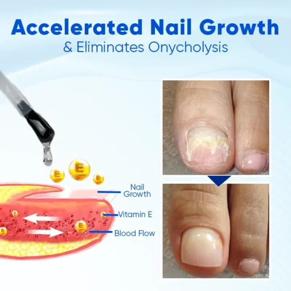 LOVILDS™ OnyxoGuard Nail Growth and Repair Serum