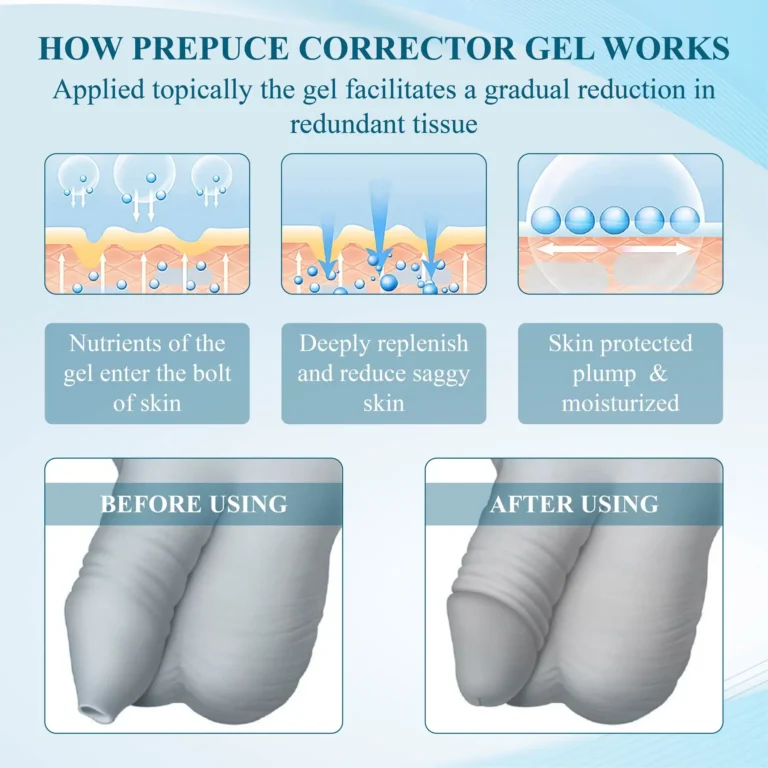 MaleGuard™ Redundant PrepuceCorrector Gel