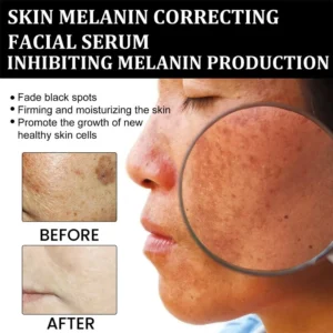 NESLEMY™ Melanin Correcting Facial Serum