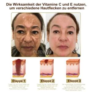 PLTOWE® leistungsstarke Ganzkörper-Hautpflegecreme