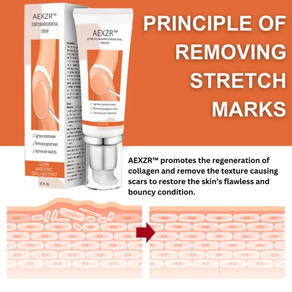 AEXZR™ Stretchmarks Removal Cream