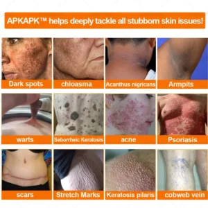 APKAPK™ Effective All-in-One Skin Treatment Cream