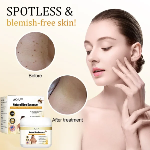 AQA™ Natural Bee Essence Mole and Wart Treatment Cream - Image 11