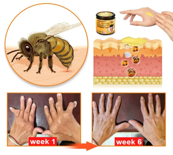 Furzero™ Bee Venom & Turmeric Joint and Bone Pain Relief Cream