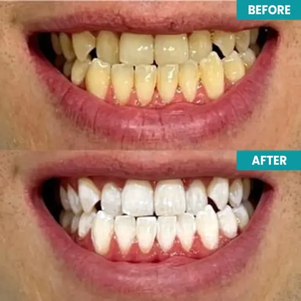 LIMETOW™ Instant Teeth Whitening Paint - Image 9