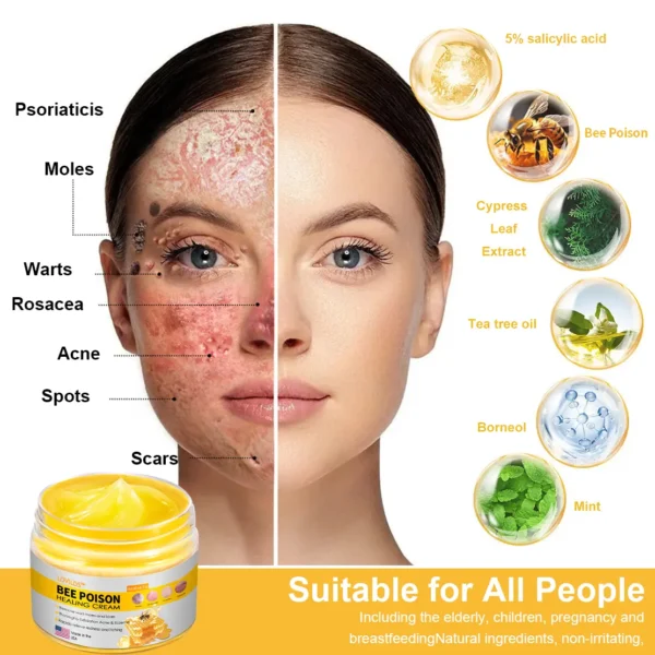 LOVILDS™ Bee Poison Skin Cream - Image 11