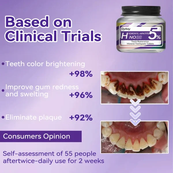 Oyikey™ Teeth Restoration Mineral Toothpaste Tablets