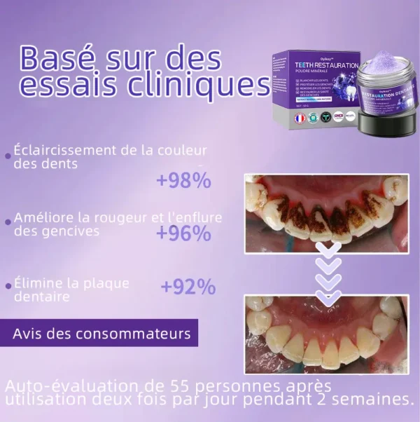 Oyikey™ Teeth Restoration Poudre Minérale