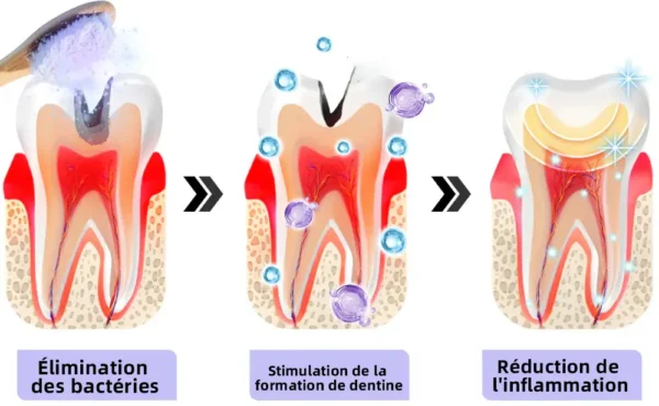 Oyikey™ Teeth Restoration Poudre Minérale